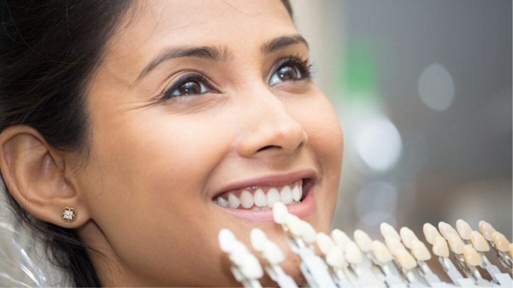 Women Selecting Dental Veneer Shade